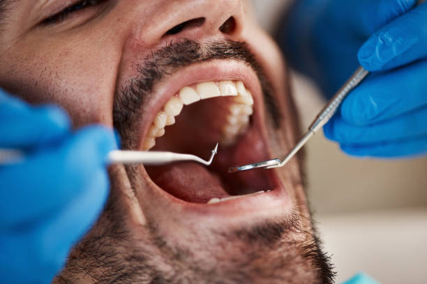 Best Emergency Gum Pain Relief  in Mounds, OK