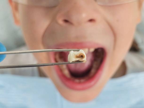 Best Urgent Tooth Repair  in Mounds, OK